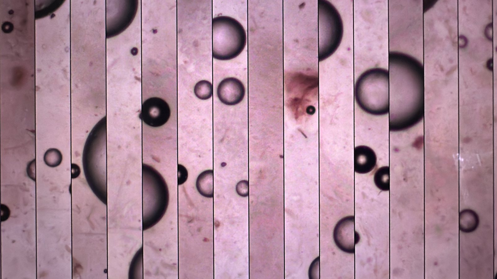 Pale pink microscope view of round bubbles, cut into vertical strips.